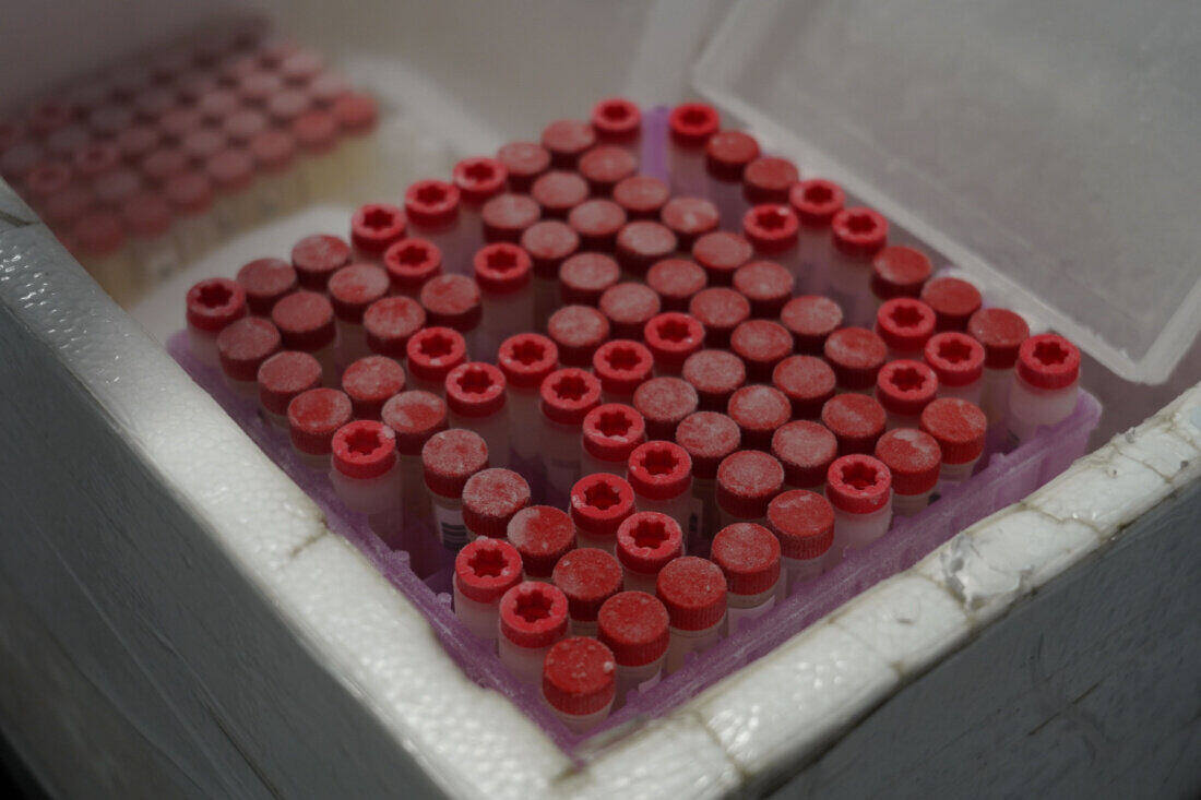 Shipping blood samples and other biological specimen with express services.